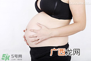 牛皮癣会不会遗传？牛皮癣会遗传给孩子吗？