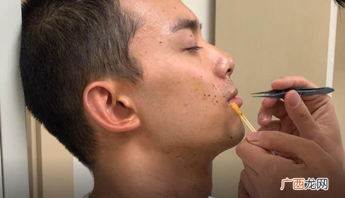 吴磊的眼睛，吴磊拍戏意外炸伤眼睛