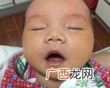 新生儿黄疸吃什么药能退黄?新生儿黄疸吃什么药效果好?