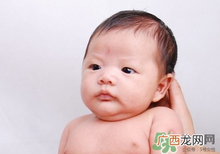 新生儿脸上长小白点是怎么回事?是什么原因?