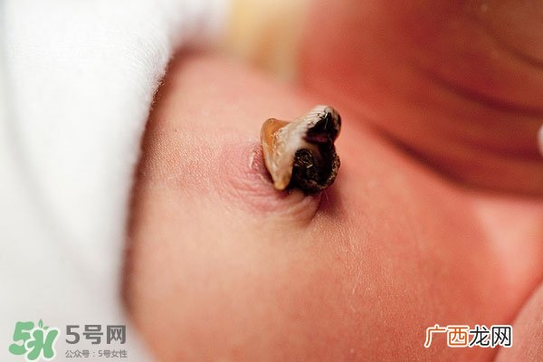 如何清洁宝宝肚脐宝宝脐带的护理方法