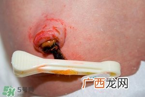 如何清洁宝宝肚脐宝宝脐带的护理方法