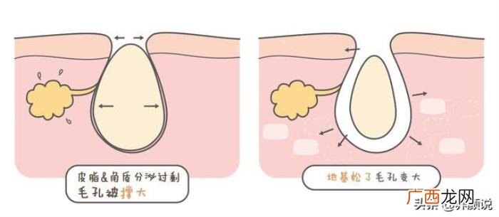 我终于知道洗脸最佳水温了 用热水洗脸好吗