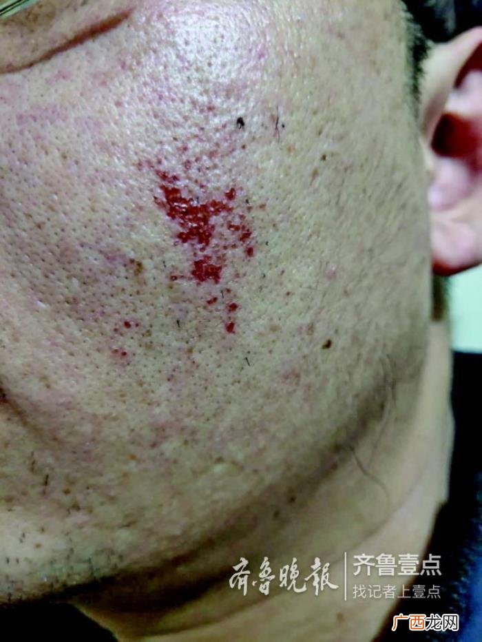 男子网购面部脱毛膏 男士脸部脱毛膏