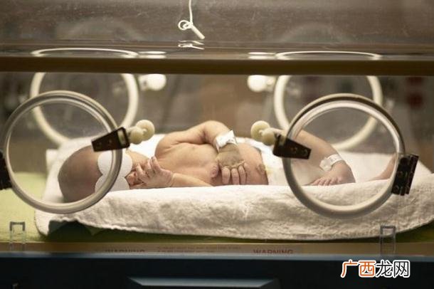 新生儿黄疸吃什么药新生儿黄疸的检测方法