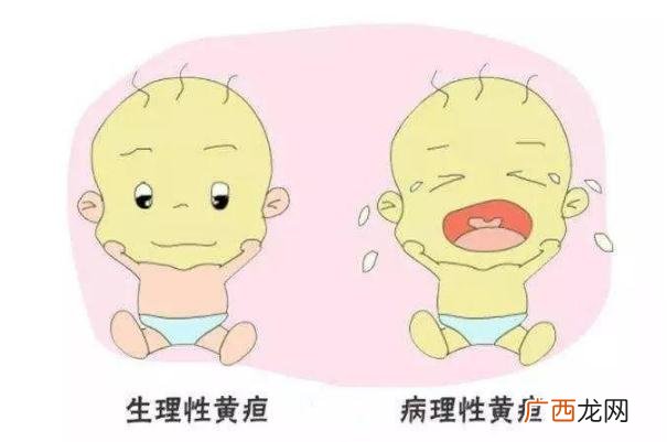 新生儿黄疸是什么原因引起的新生儿黄疸多久能退完