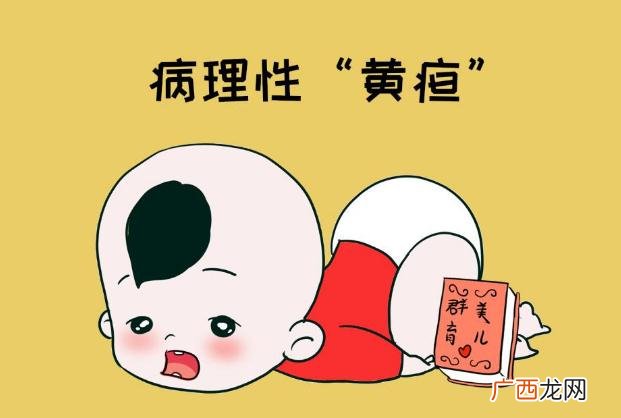 新生儿黄疸是什么原因引起的新生儿黄疸多久能退完