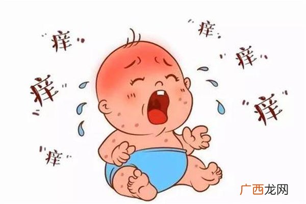 宝宝耳朵湿疹怎么办宝宝湿疹什么原因造成的