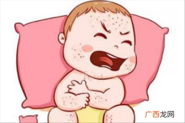 宝宝耳朵湿疹怎么办宝宝湿疹什么原因造成的