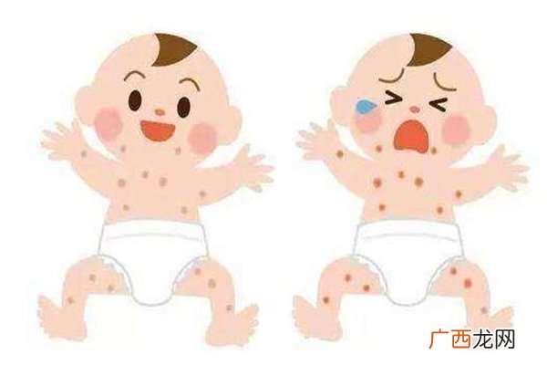 宝宝脸上长奶癣是怎么回事怎么办