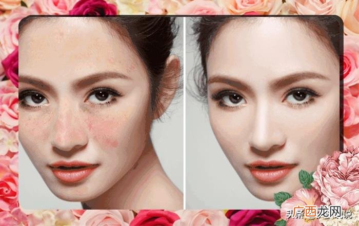 奢侈护肤和光子美白谁优谁劣 光子嫩肤可以美白吗
