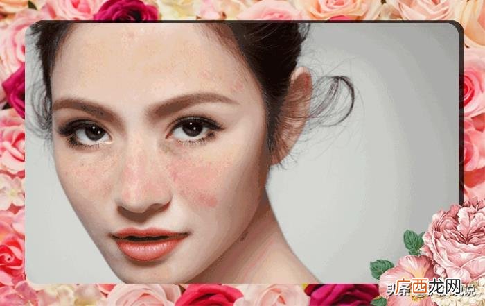 奢侈护肤和光子美白谁优谁劣 光子嫩肤可以美白吗