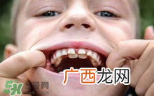 儿童换牙可以吃钙片吗?儿童换牙吃什么好？