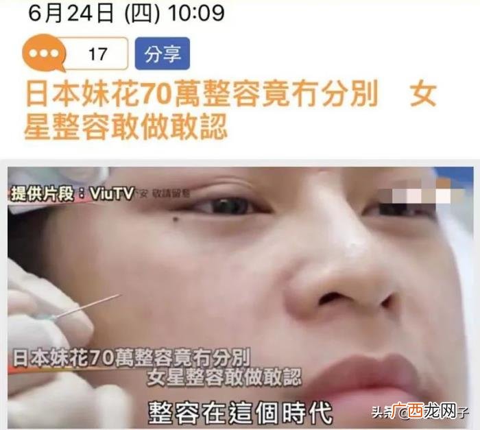 4年花58万整容整了个寂寞 斯容整容前后