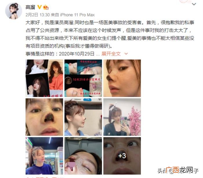 4年花58万整容整了个寂寞 斯容整容前后