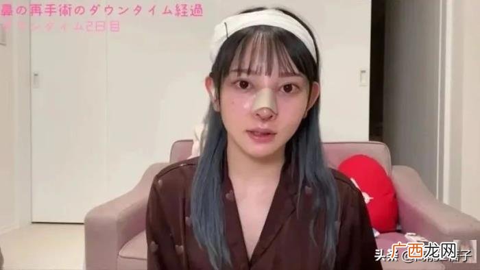 4年花58万整容整了个寂寞 斯容整容前后