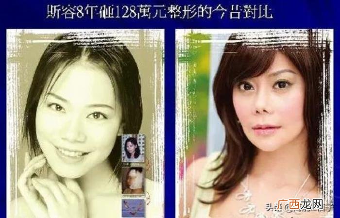 4年花58万整容整了个寂寞 斯容整容前后