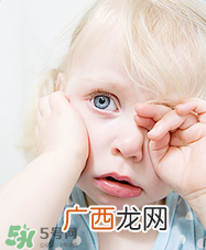 宝宝总是拿手揉眼睛是怎么了？宝宝眼睛痒怎么处理？