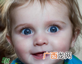 宝宝总是拿手揉眼睛是怎么了？宝宝眼睛痒怎么处理？