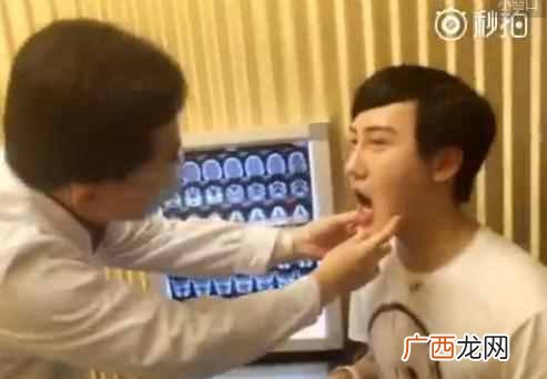刘梓晨家庭背景及父母 刘梓晨整容前后对比