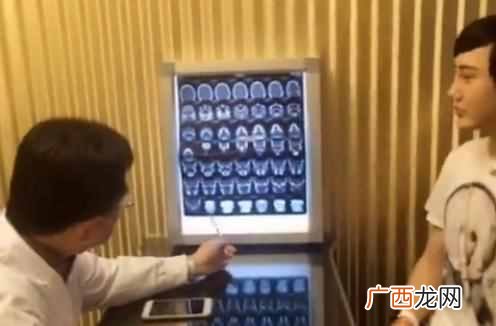 刘梓晨家庭背景及父母 刘梓晨整容前后对比