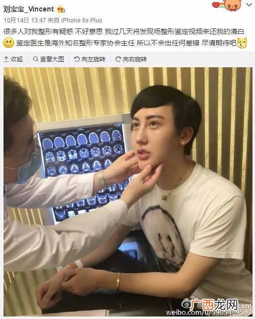 刘梓晨家庭背景及父母 刘梓晨整容前后对比