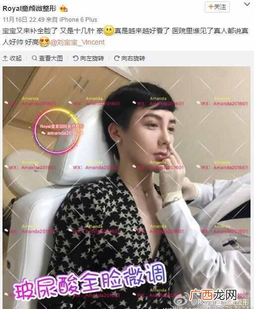 刘梓晨家庭背景及父母 刘梓晨整容前后对比