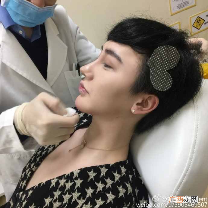 刘梓晨家庭背景及父母 刘梓晨整容前后对比