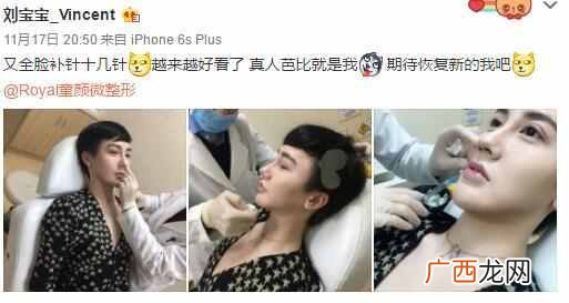 刘梓晨家庭背景及父母 刘梓晨整容前后对比