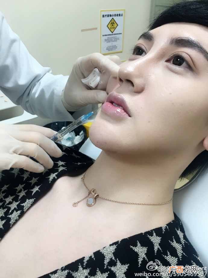 刘梓晨家庭背景及父母 刘梓晨整容前后对比