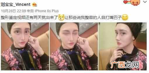 刘梓晨家庭背景及父母 刘梓晨整容前后对比