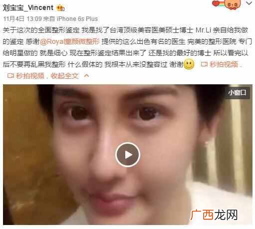 刘梓晨家庭背景及父母 刘梓晨整容前后对比