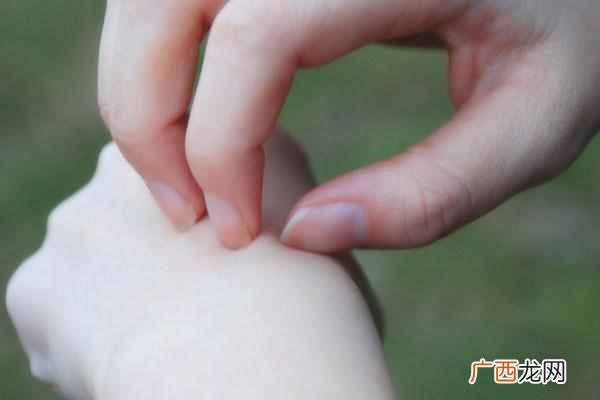 蚊子喜欢咬什么血型的人（5类人是蚊子最喜欢的