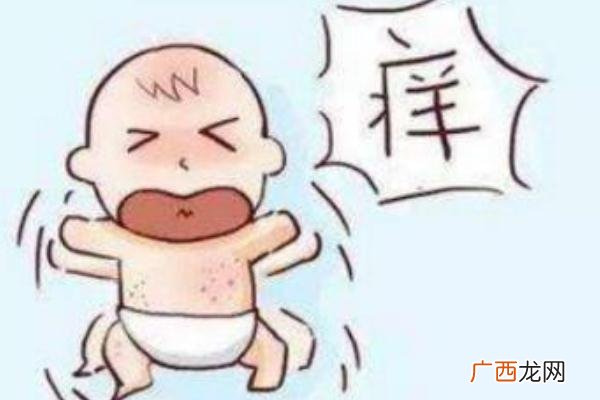 婴儿湿疹反复发作原因婴儿湿疹怎么治才能好得快