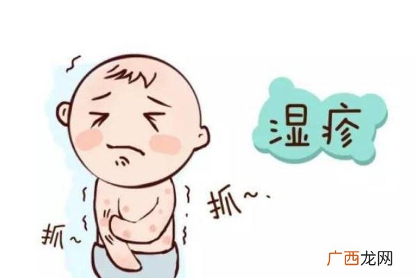婴儿湿疹是什么原因引起的起的婴儿湿疹怎么护理好得快