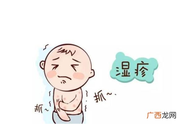 婴儿湿疹可以晒太阳吗婴儿湿疹可以自愈吗
