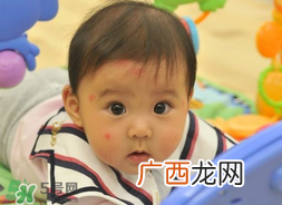 婴儿被蚊子咬了如何去红点？被蚊子咬后红点如何去除？