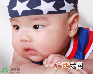 婴儿被蚊子咬了如何去红点？被蚊子咬后红点如何去除？