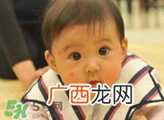 婴儿蚊子咬了怎么消肿?婴儿蚊子咬了怎么消肿止痒最快?