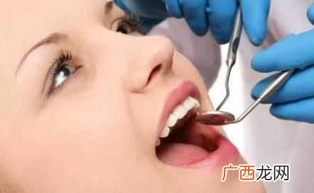 拔智齿收费价目表 拔智齿多少钱一颗