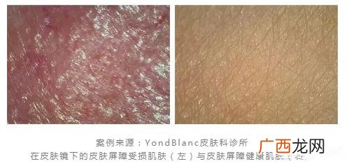 天天敷面膜是不对的 面膜不是敷的越多越好