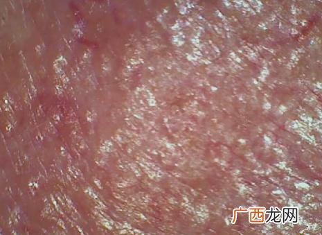 天天敷面膜是不对的 面膜不是敷的越多越好