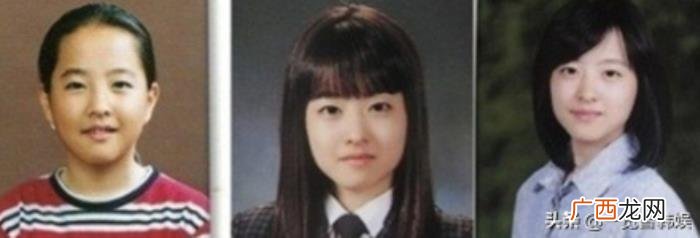 朴宝英受伤粉丝心疼不已 朴宝英魔女幼熙