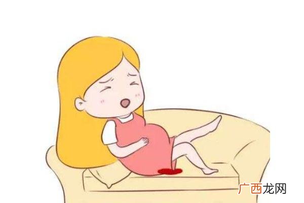 孕妇流产后饮食注意事项