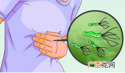 感染幽门螺杆菌有什么症状-幽门螺杆菌阳性会得什么病