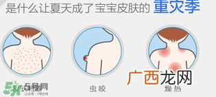 妙思乐爽肤水好用吗？妙思乐爽肤水能去痱吗？