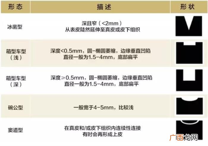 这3种去痘疤的方法有效 快速去痘疤的方法