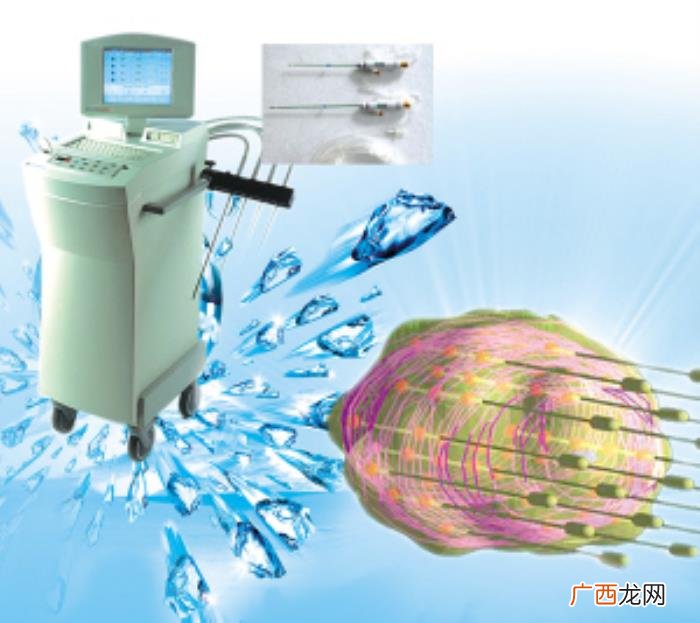 这3种去痘疤的方法有效 快速去痘疤的方法