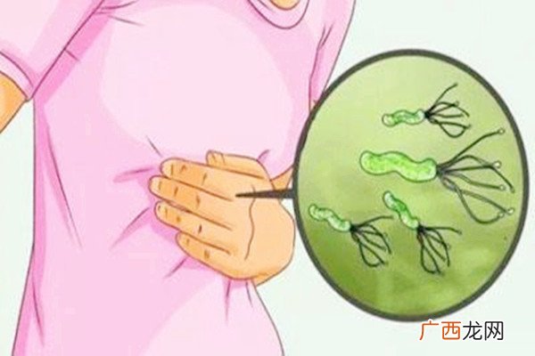 45岁女子感染幽门螺杆菌致胃癌-幽门螺旋杆菌是如何感染的
