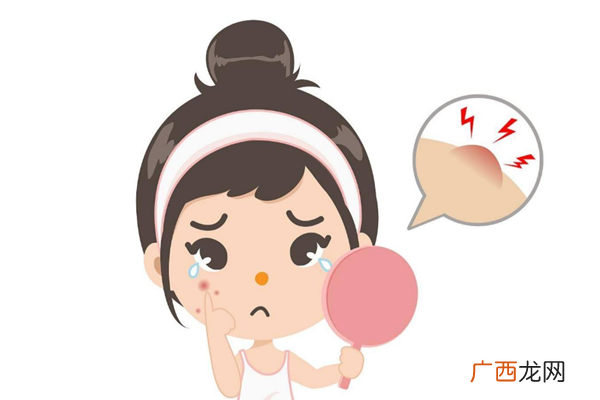 眉毛上长痘痘是什么原因-痘痘会自己好吗